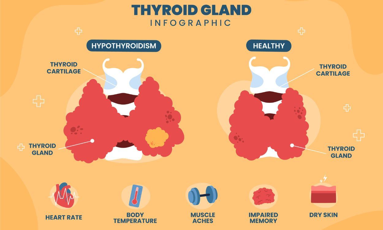 What Is Thyroid Cancer Fitpaa